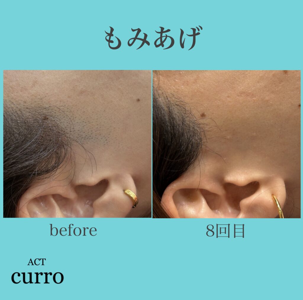 横浜日吉脱毛サロン