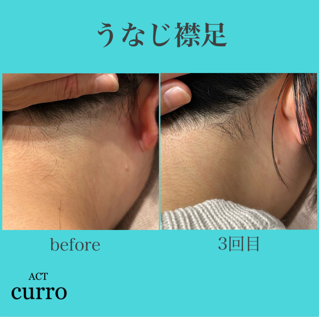 横浜日吉脱毛サロン