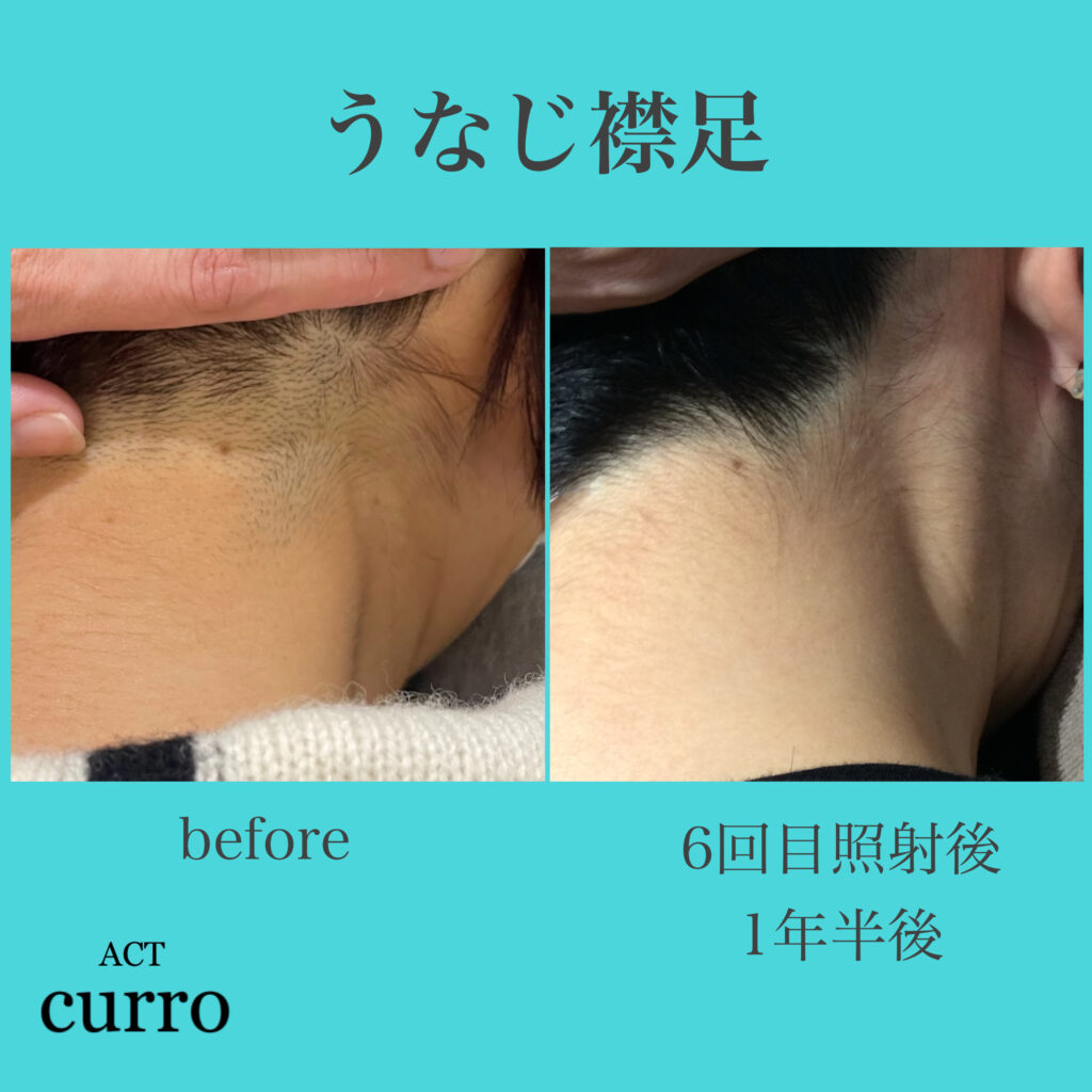 横浜日吉脱毛サロン