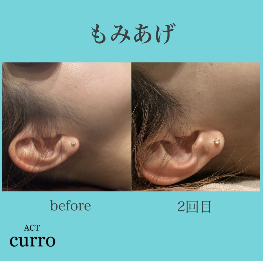 横浜日吉脱毛サロン