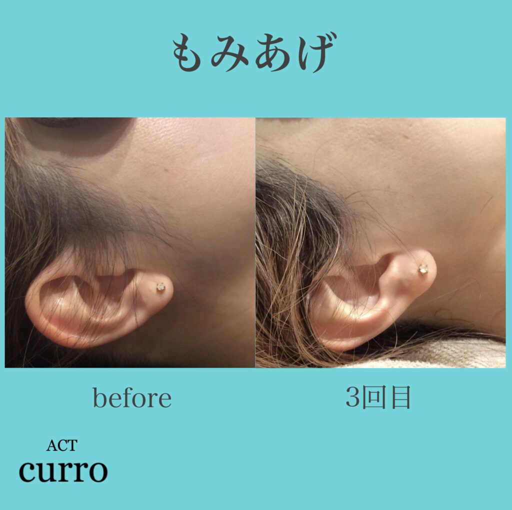 横浜日吉脱毛サロン