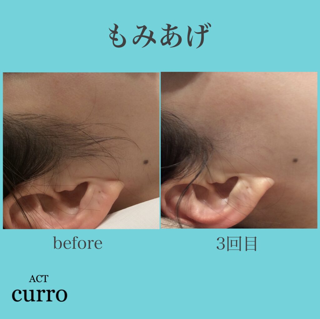 横浜日吉脱毛サロン
