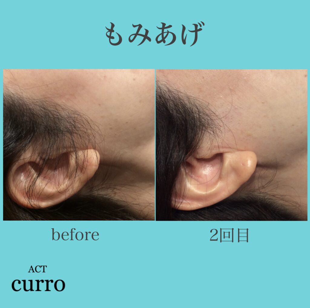 横浜日吉脱毛サロン